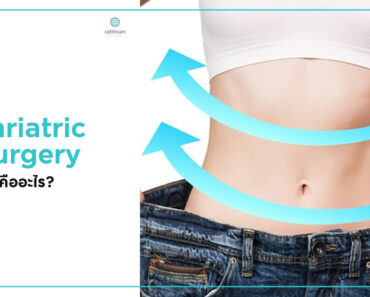 Bariatric Surgery คืออะไร?